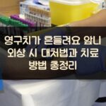 영구치가 흔들려요 앞니 외상 시 대처법과 치료 방법 총정리