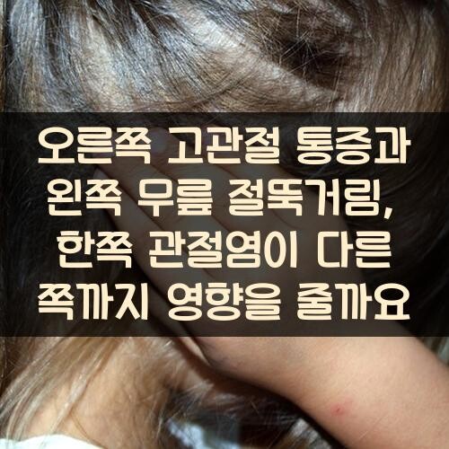 오른쪽 고관절 통증과 왼쪽 무릎 절뚝거림, 한쪽 관절염이 다른 쪽까지 영향을 줄까요?