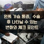 왼쪽 가슴 통증, 수술 후 나타날 수 있는 변화와 체크 포인트