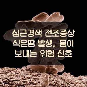 심근경색 전조증상 식은땀 발생, 몸이 보내는 위험 신호