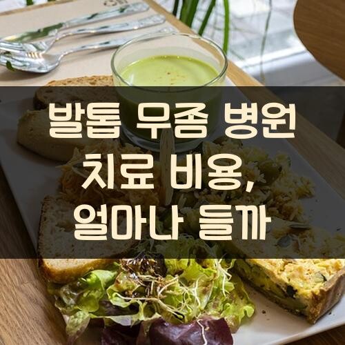 발톱 무좀 병원 치료 비용, 얼마나 들까?