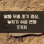 발톱 무좀 초기 증상, 놓치기 쉬운 변화 5가지