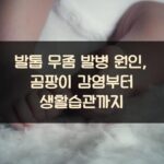 발톱 무좀 발병 원인, 곰팡이 감염부터 생활습관까지 1 발톱 무좀 발병 원인, 곰팡이 감염부터 생활습관까지